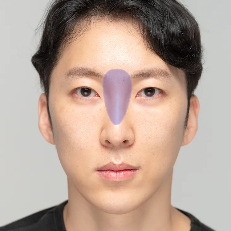 treatment_area_hyaluronic_img